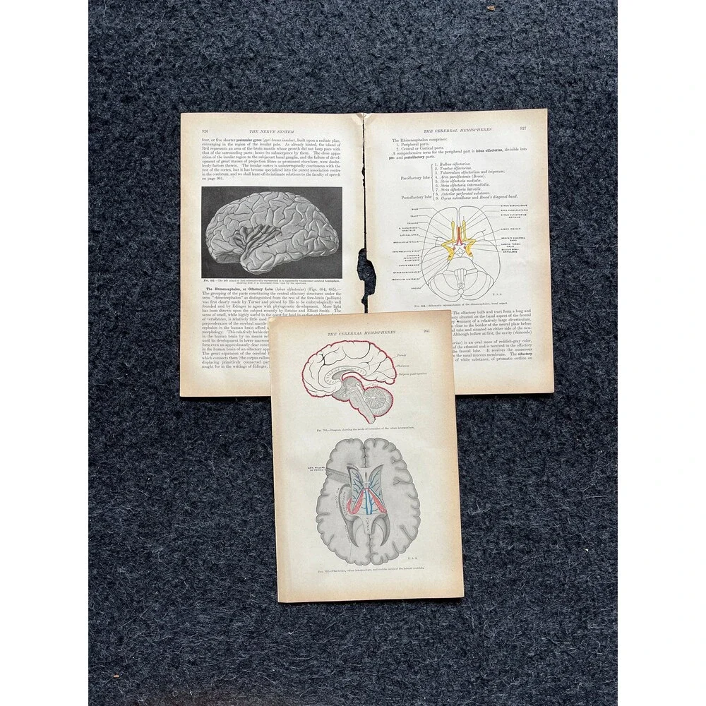 Original 1913 Anatomy Pages of Human Body, Anatomy Physiology Textbook Gifts, T
